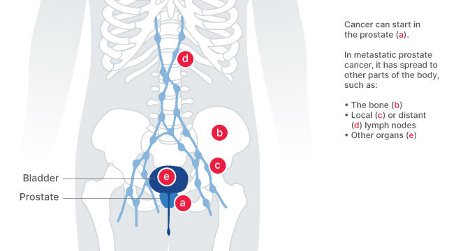 Basic prostate anatomy